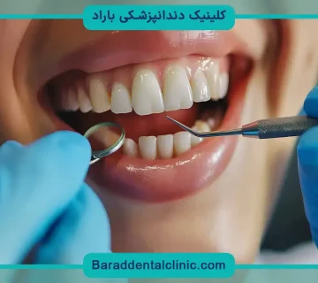 قیمت کامپوزیت کل دندان ها