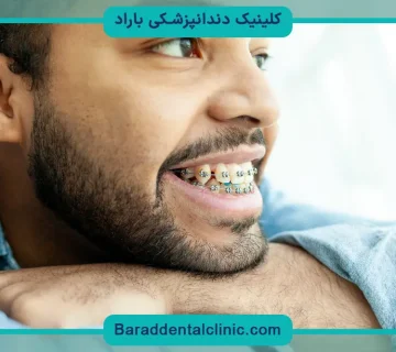 سیم کشی دندان چگونه است؟