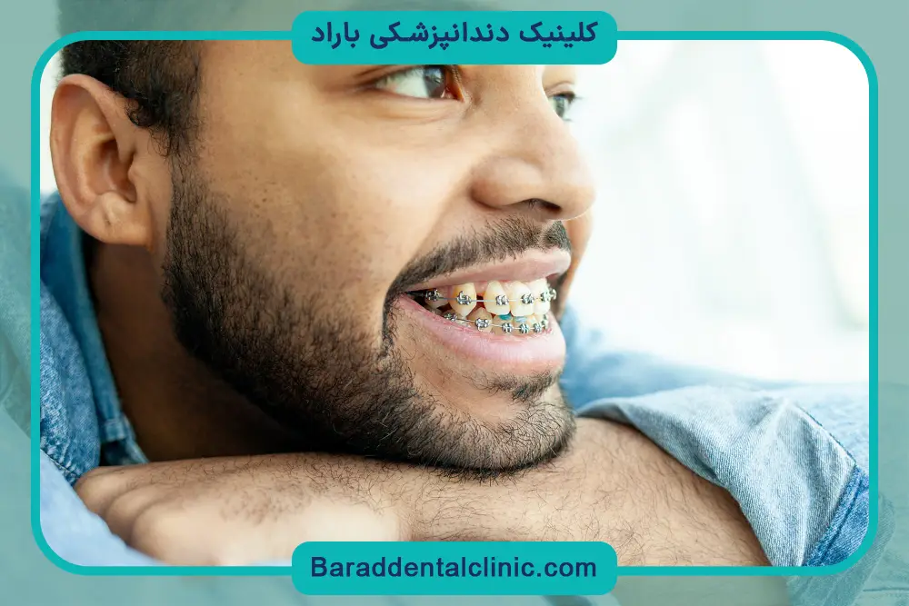 سیم کشی دندان چگونه است؟