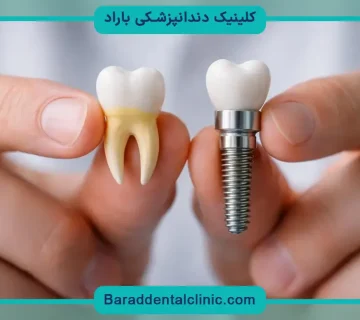 بهترین مرکز ایمپلنت تهران