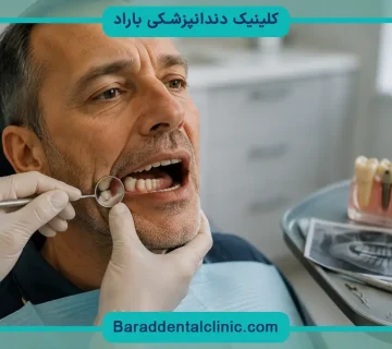 قیمت ایمپلنت فوری