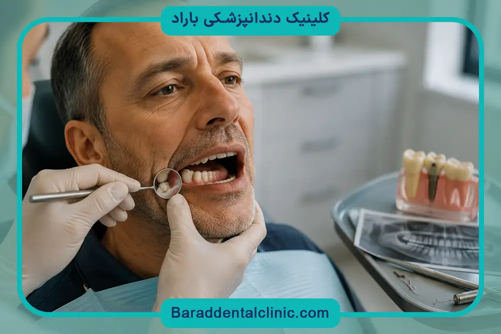 قیمت ایمپلنت فوری