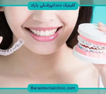 سیم کشی دندان چگونه انجام میشود؟