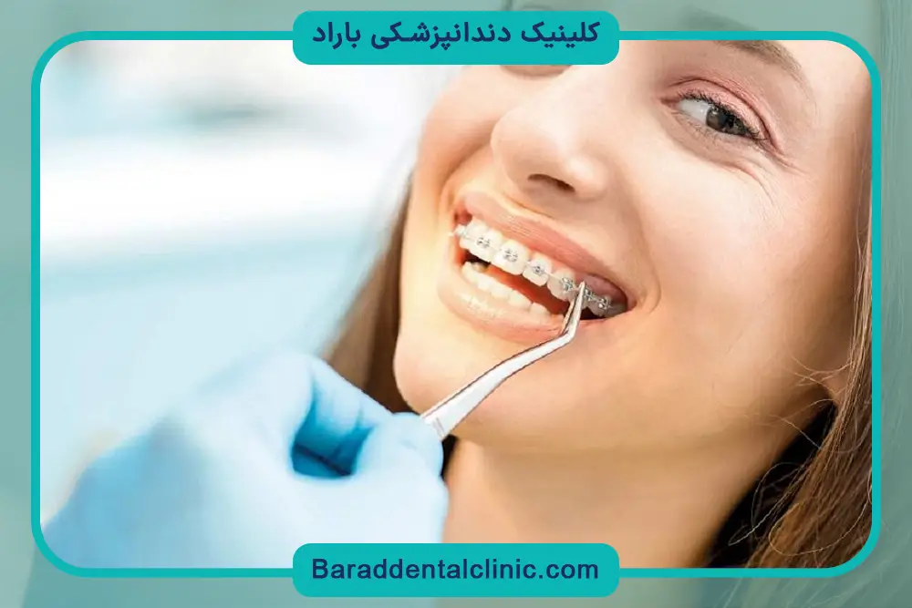 میانگین هزینه سیم کشی دندان چقدر است؟