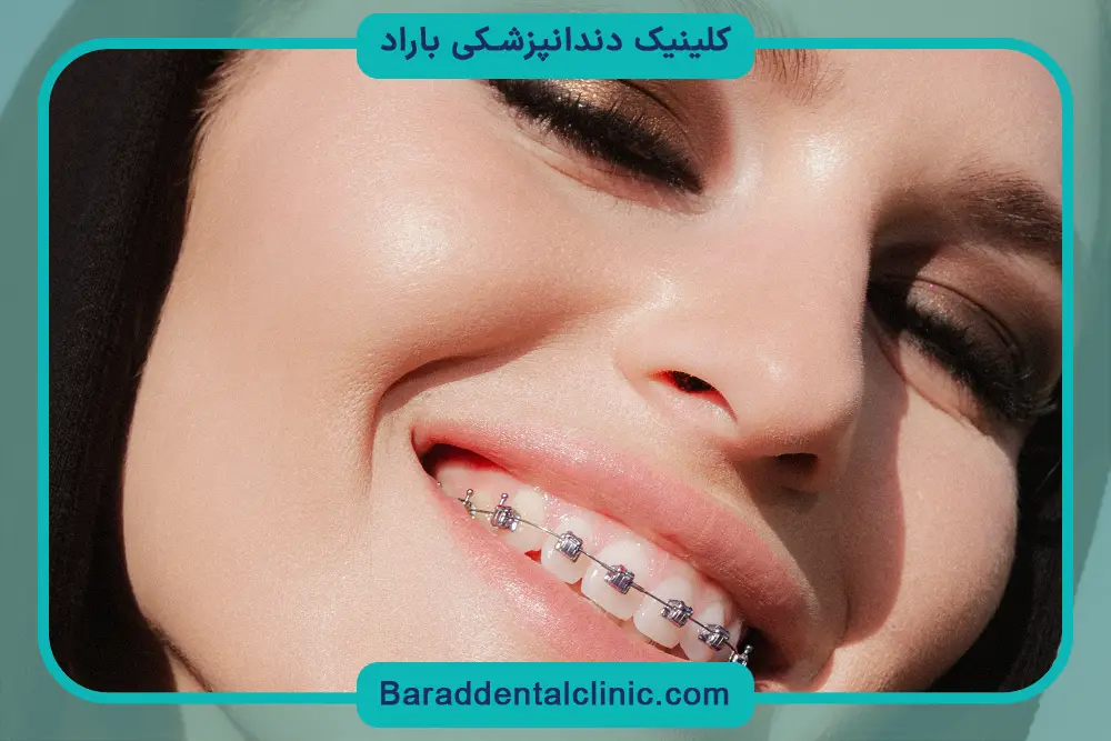 سیم کشی دندان چگونه است؟ آمادگی اولیه