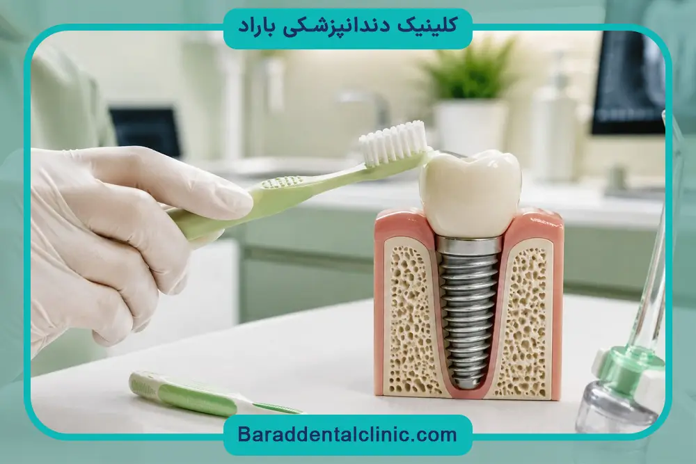 بررسی قیمت ایمپلنت دندان در تهران 