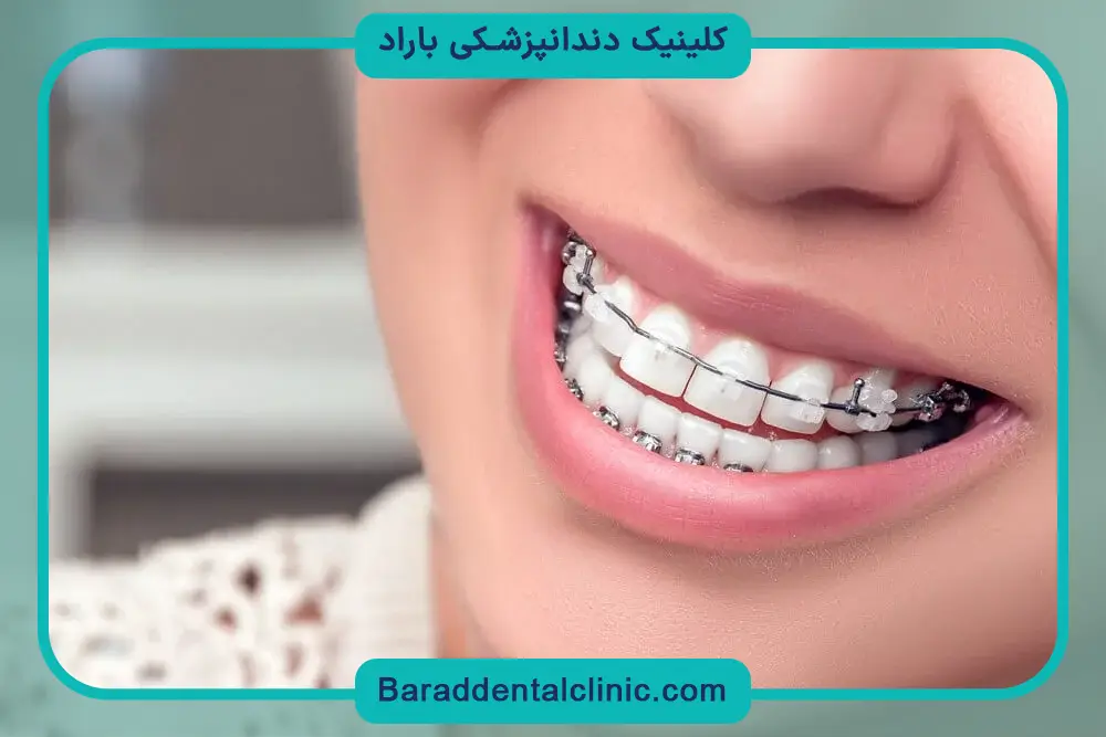 سیم کشی دندان چگونه انجام میشود؟  معاینه اولیه