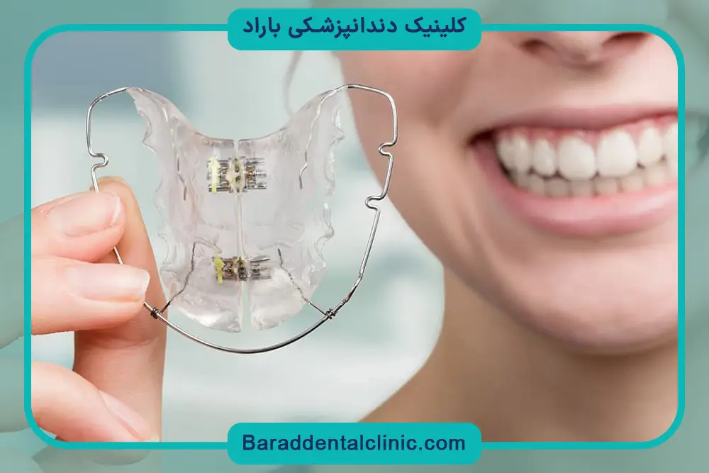 هزینه سیم کشی دندان چقدر است؟ عوامل موثر بر هزینه