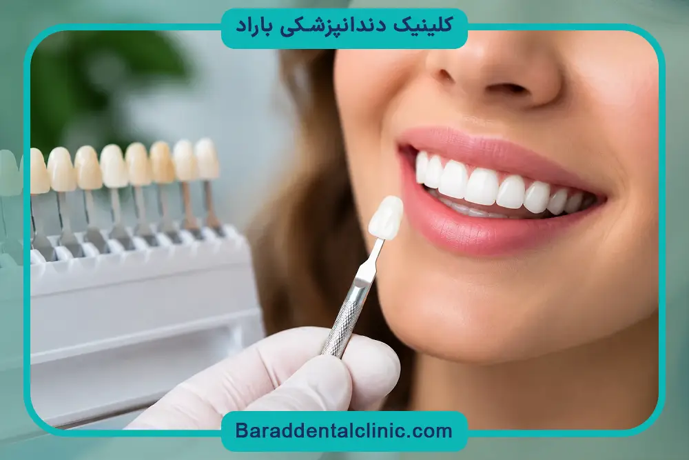 تاثیر برند روی قیمت کامپوزیت کل دندان ها 