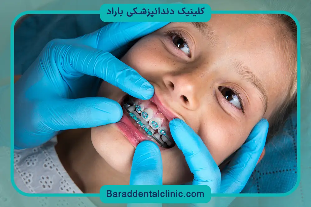 سیم کشی دندان چگونه است؟ نحوه اثرگذاری