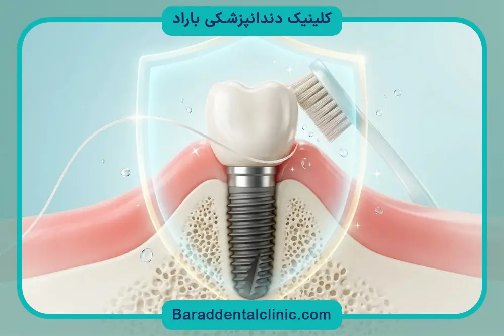 تاثیر برند روی قیمت ایمپلنت فوری 