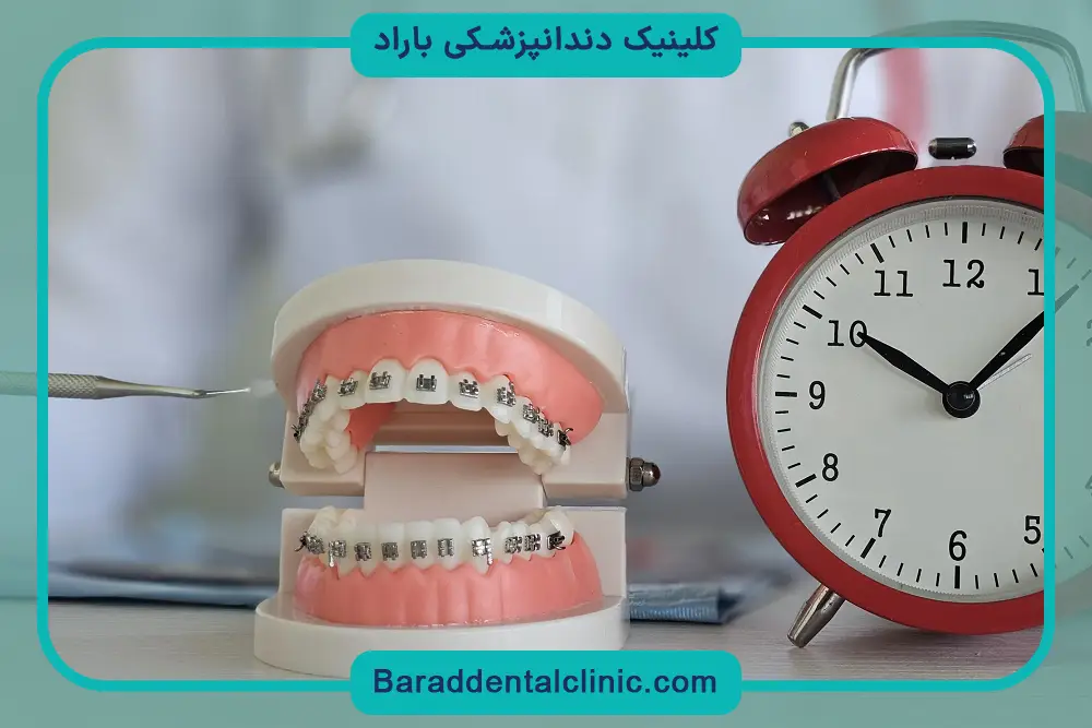 بررسی پلاک نگهدارنده ارتودنسی