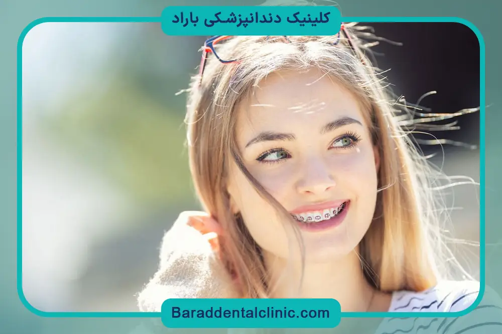 سیم کشی دندان چگونه است؟ فاصله زمانی جلسات
