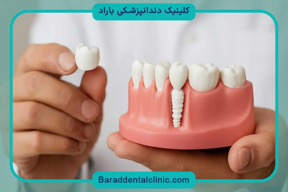 تاثیر فناوری‌های دیجیتال روی قیمت ایمپلنت فوری 