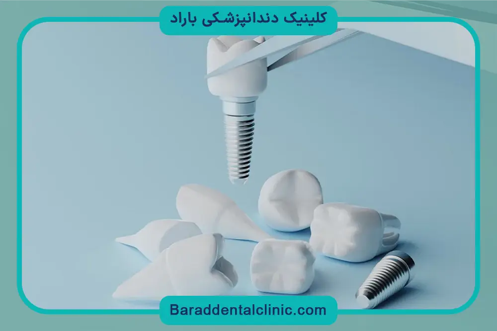 کاندیدای ایمپلنت کره ای