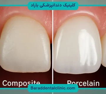 بهترین کلینیک کامپوزیت تهران