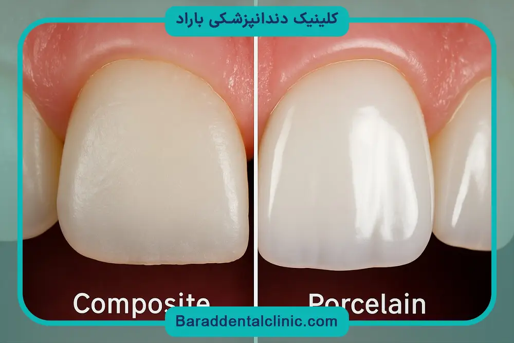 بهترین کلینیک کامپوزیت تهران