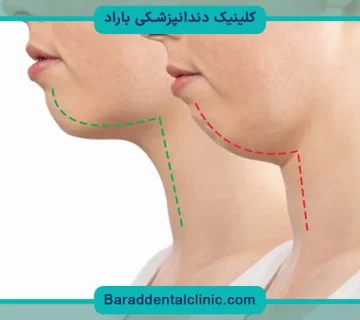 جراحی ارتوگناتیک