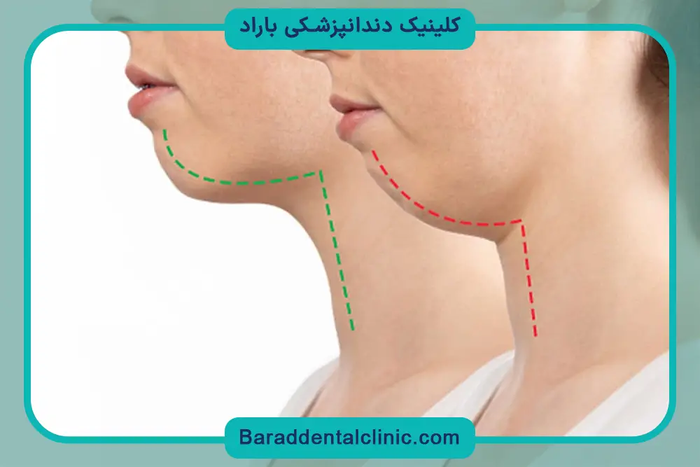جراحی ارتوگناتیک