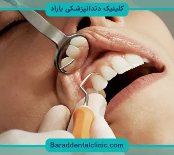 بهترین متخصص ایمپلنت تهران