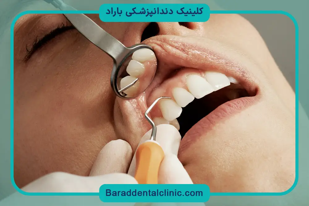بهترین متخصص ایمپلنت تهران