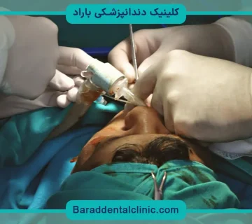 عوارض جراحی فک