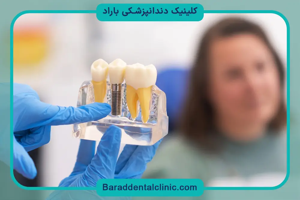 ایمپلنت اقساطی بدون چک