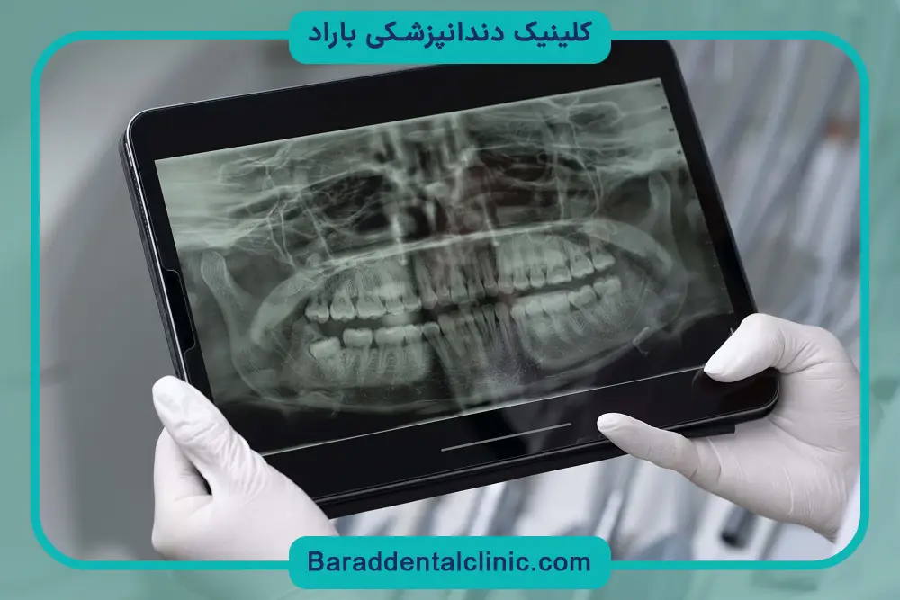 ایمپلنت دیجیتال بهتره یا معمولی