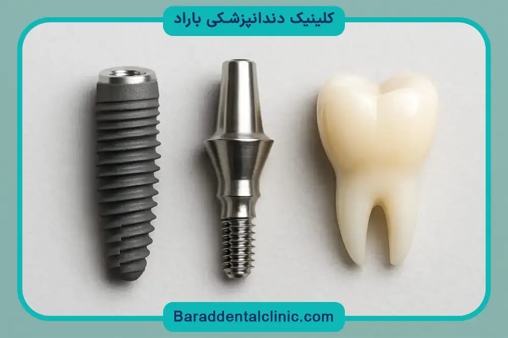شایعترین عوارض ایمپلنت دندان