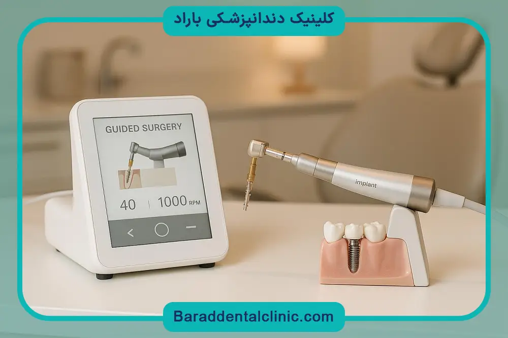 بررسی قیمت ایمپلنت دیجیتال در تهران 