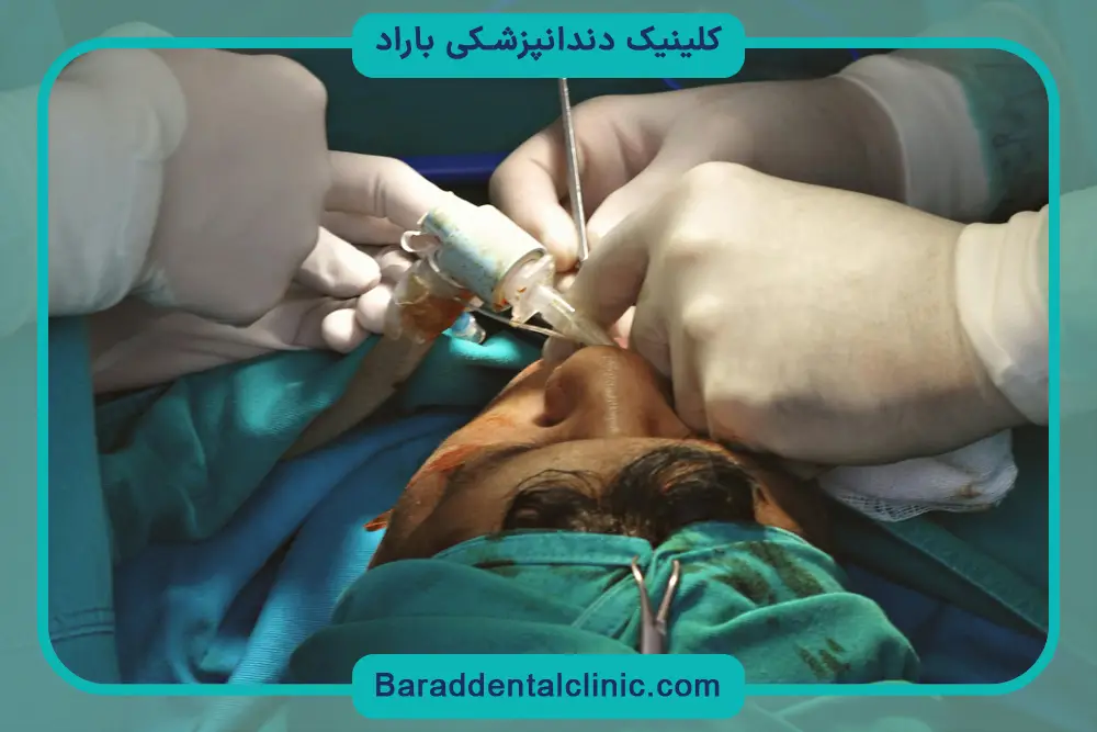 بررسی هزینه جراحی فک 