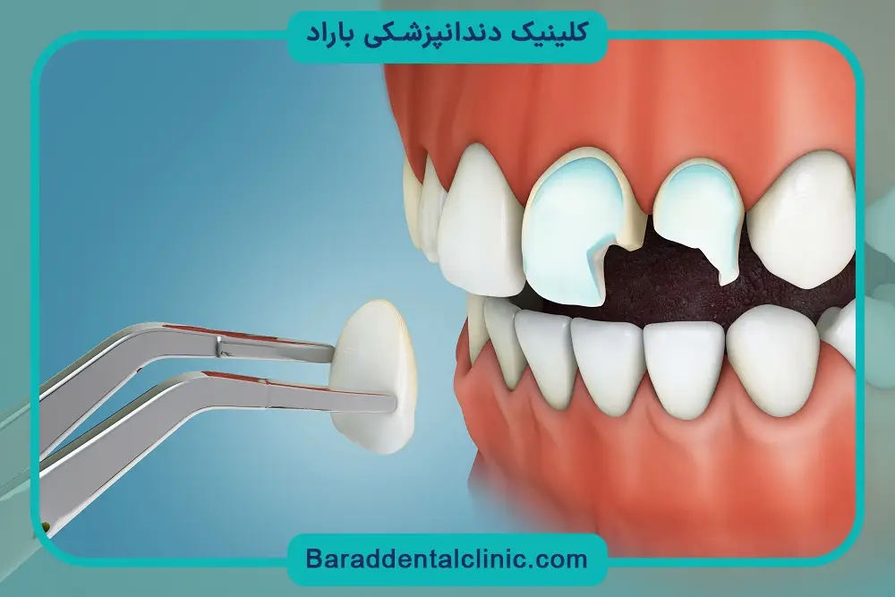 تخصص دندانپزشک در بهترین کلینیک کامپوزیت تهران 