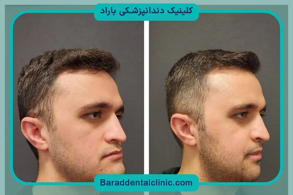 تفاوت جراحی ارتوگناتیک با ارتودنسی