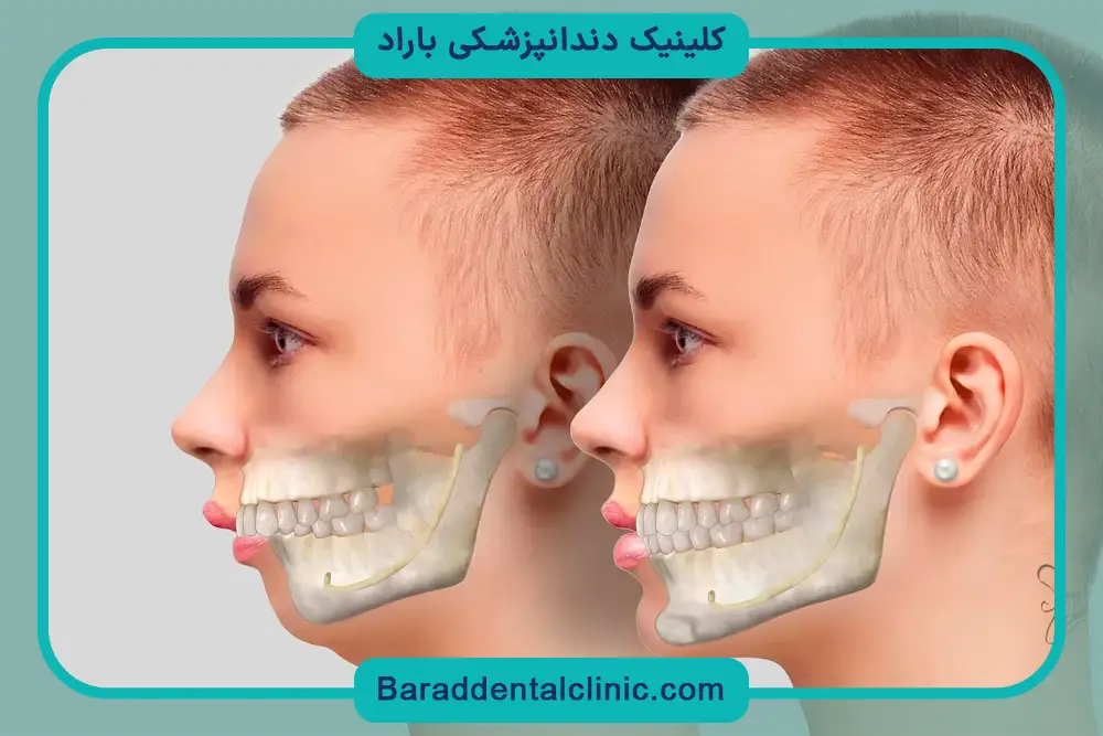 آمادگی قبل از جراحی ارتوگناتیک 