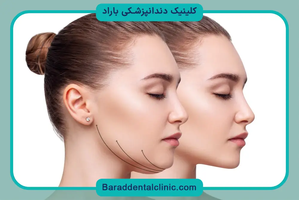 هزینه‌های جانبی جراحی فک 