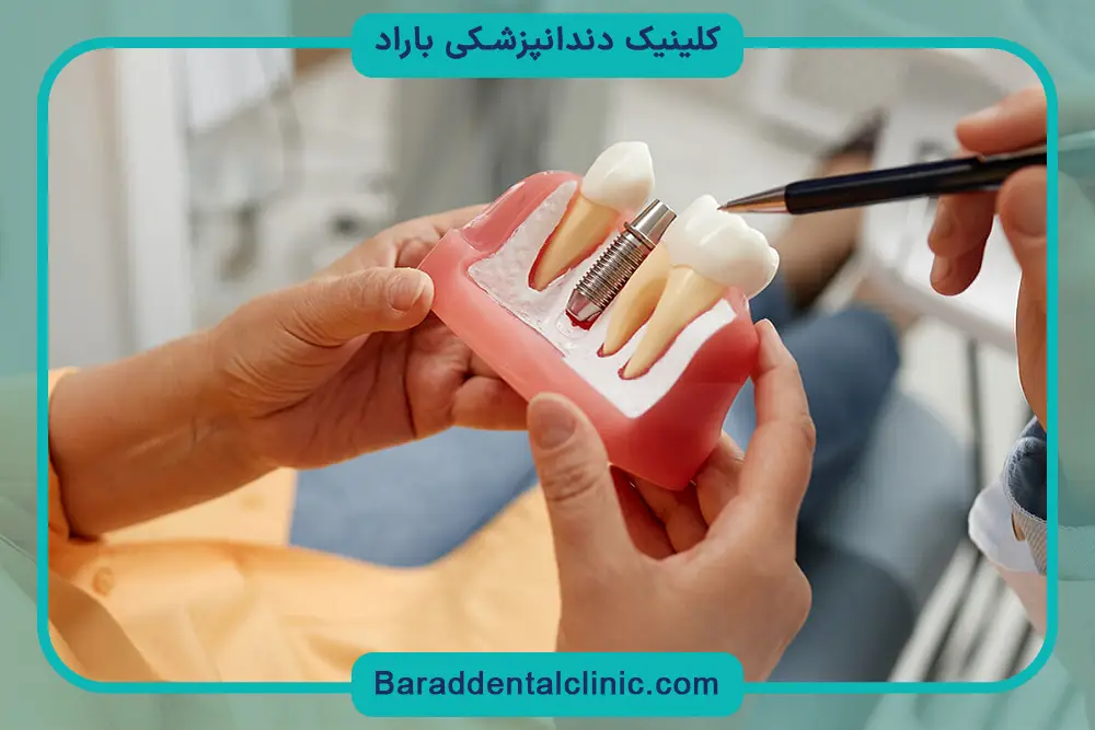 عوامل موثر بر نتیجه ایمپلنت فوری